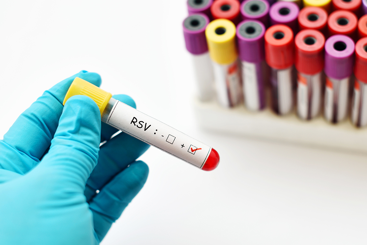 ไวรัส RSV , โรค RSV ในเด็ก